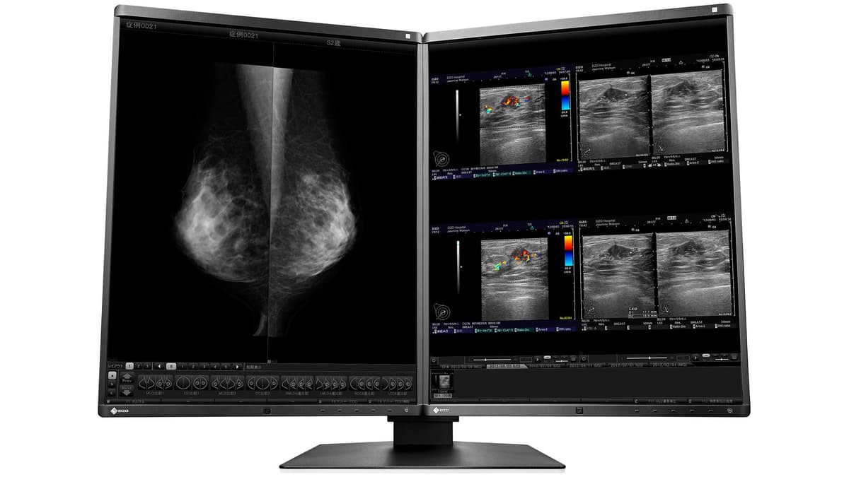 EIZO - MATCHED FOR MAMMODUO SOLUTION (ALWAYS ORDER PAIRWISE) DOWN