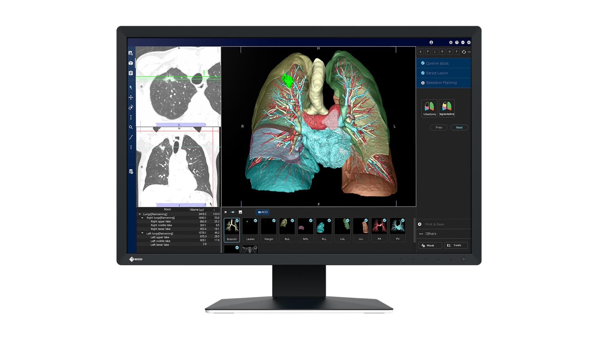 EIZO - 2.3MP RADIFORCE MX243W 24IN DIAGNOSTIC DISPLAY MNTR