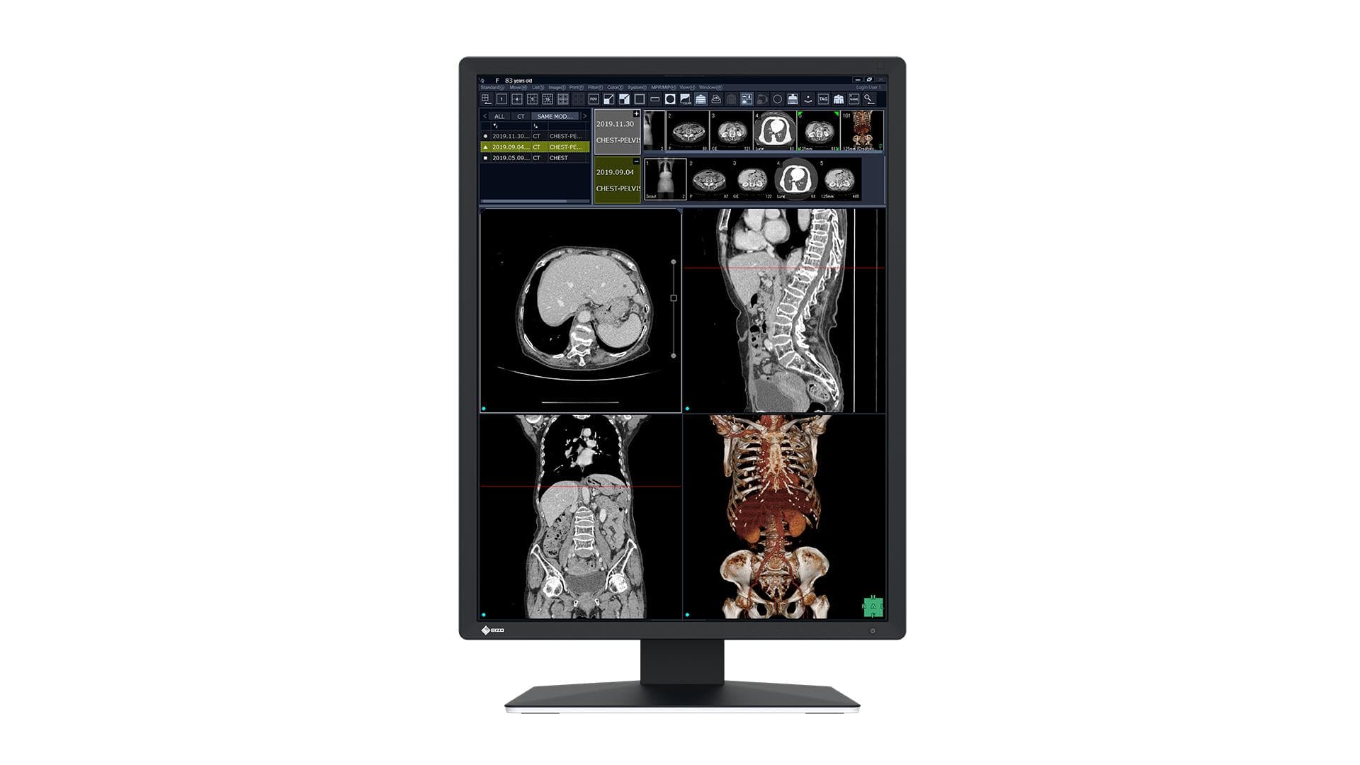 EIZO - RX270 RADIFORCE HIGH CONTRAST 2MP MONITOR FOR GREYSCALE AND CO MNTR